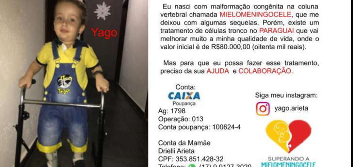 Família faz 'vaquinha' para custear tratamento de criança com malformação congênita
