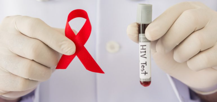 Número de diagnósticos de HIV e Aids caem 31% e 35% em Rio Preto 
