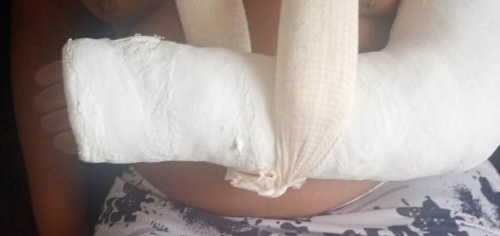 Polícia investiga agressão em escola após menino autista ter o braço quebrado