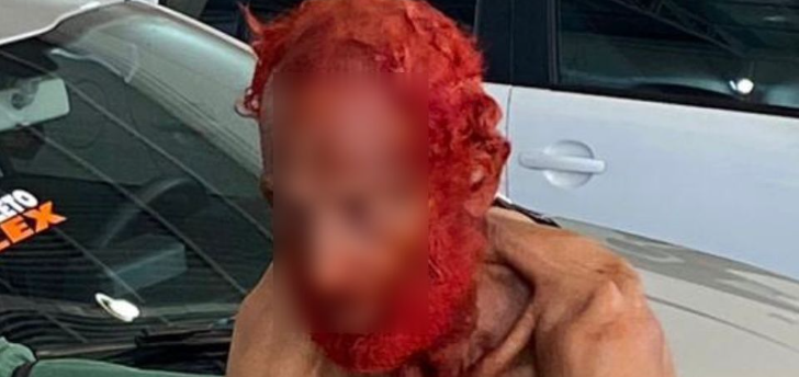 Idoso em situação de rua tem cabelo pintado para receber R$ 50 de empresário 
